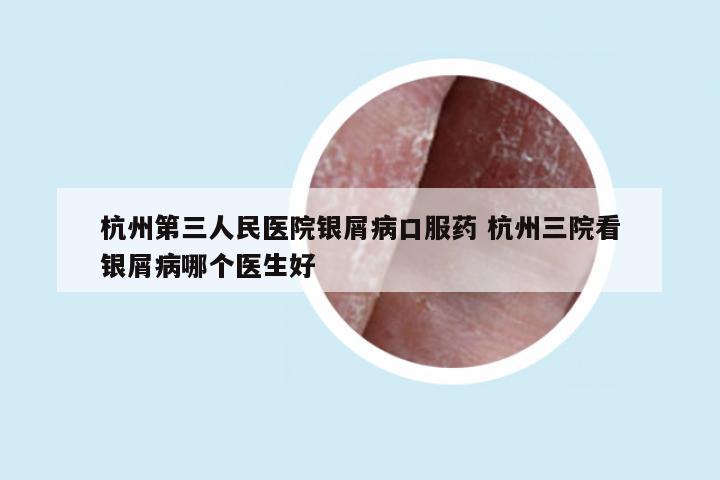杭州第三人民医院银屑病口服药 杭州三院看银屑病哪个医生好