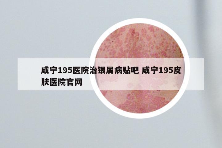 咸宁195医院治银屑病贴吧 咸宁195皮肤医院官网