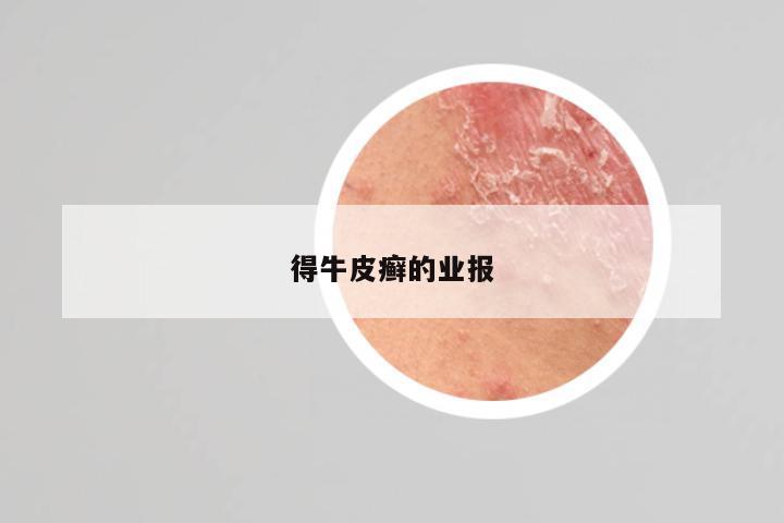 得牛皮癣的业报