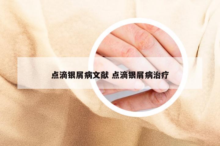 点滴银屑病文献 点滴银屑病治疗