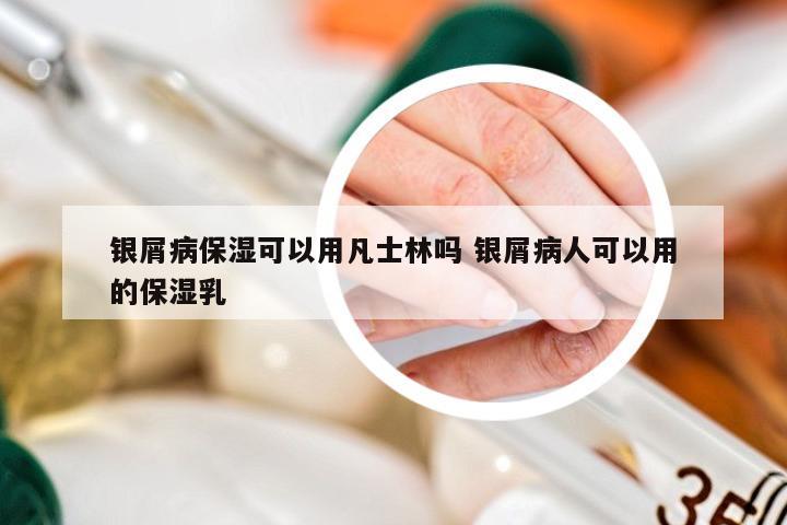 银屑病保湿可以用凡士林吗 银屑病人可以用的保湿乳