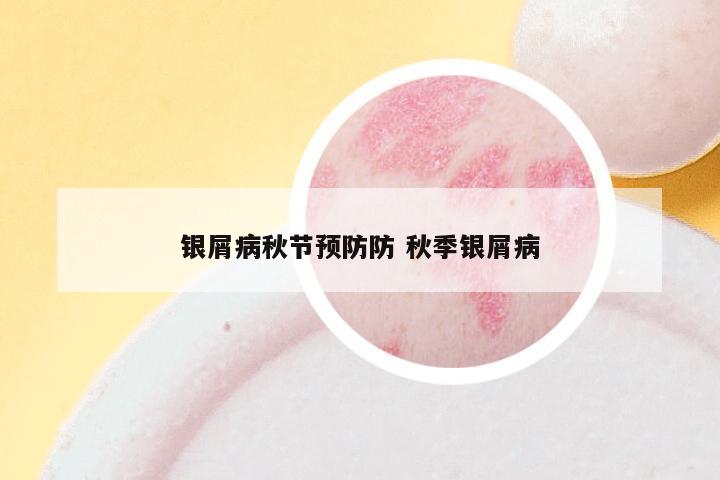 银屑病秋节预防防 秋季银屑病