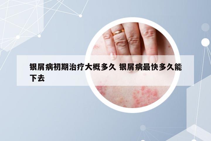 银屑病初期治疗大概多久 银屑病最快多久能下去