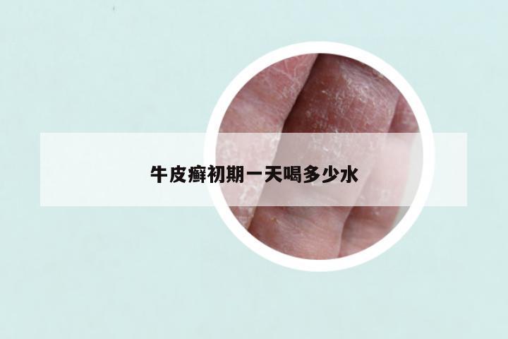 牛皮癣初期一天喝多少水