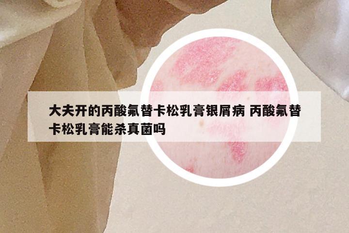 大夫开的丙酸氟替卡松乳膏银屑病 丙酸氟替卡松乳膏能杀真菌吗
