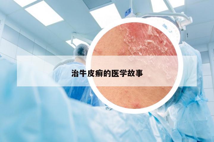 治牛皮癣的医学故事
