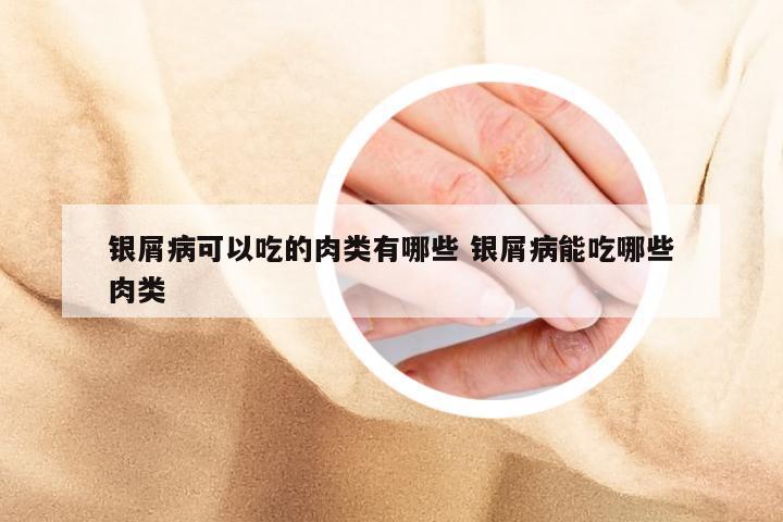 银屑病可以吃的肉类有哪些 银屑病能吃哪些肉类