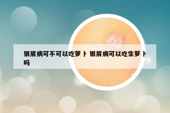 银屑病可不可以吃萝卜 银屑病可以吃生萝卜吗