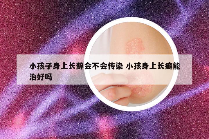 小孩子身上长藓会不会传染 小孩身上长癣能治好吗