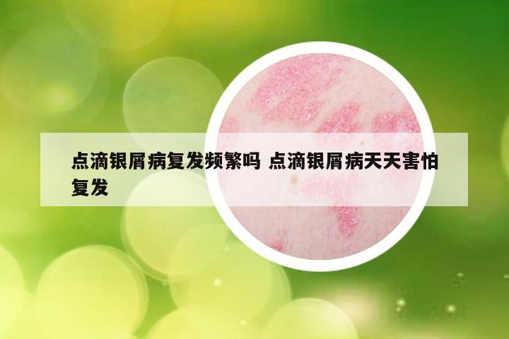 点滴银屑病复发频繁吗 点滴银屑病天天害怕复发