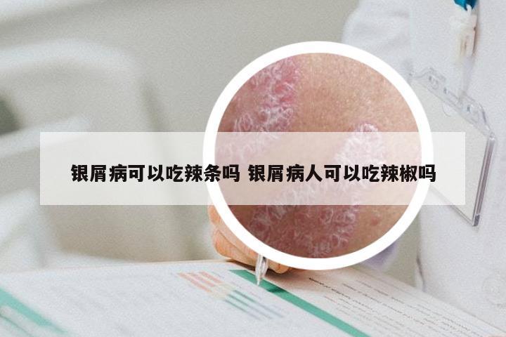银屑病可以吃辣条吗 银屑病人可以吃辣椒吗