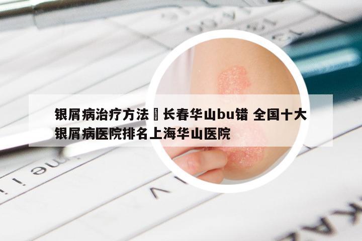 银屑病治疗方法來长春华山bu错 全国十大银屑病医院排名上海华山医院