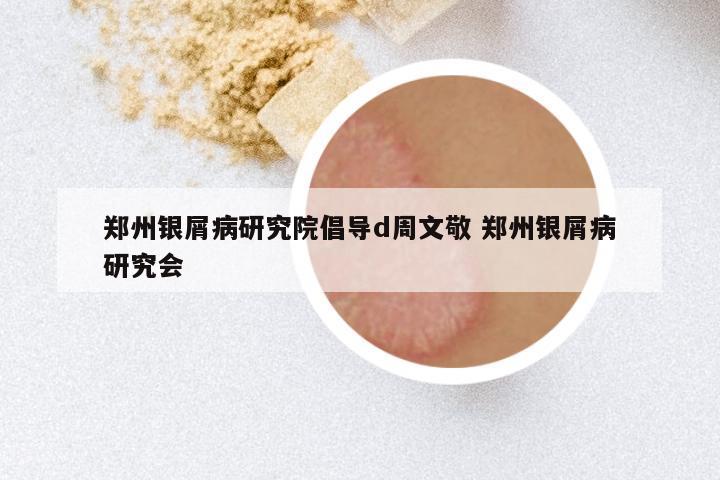 郑州银屑病研究院倡导d周文敬 郑州银屑病研究会