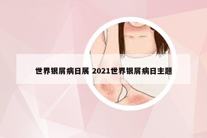 世界银屑病日展 2021世界银屑病日主题