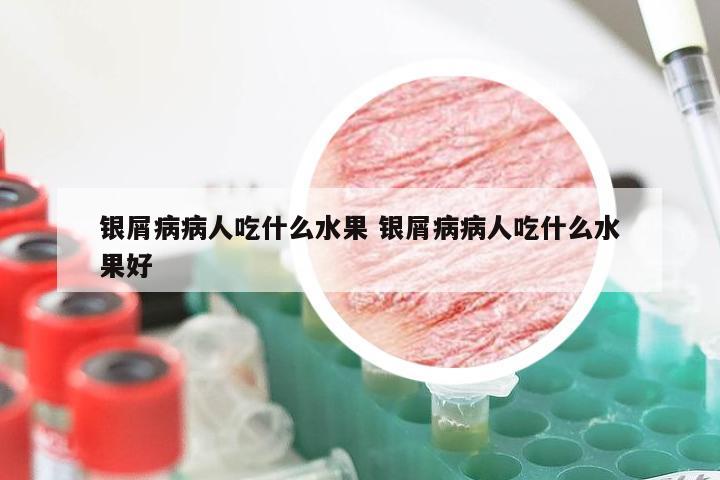 银屑病病人吃什么水果 银屑病病人吃什么水果好