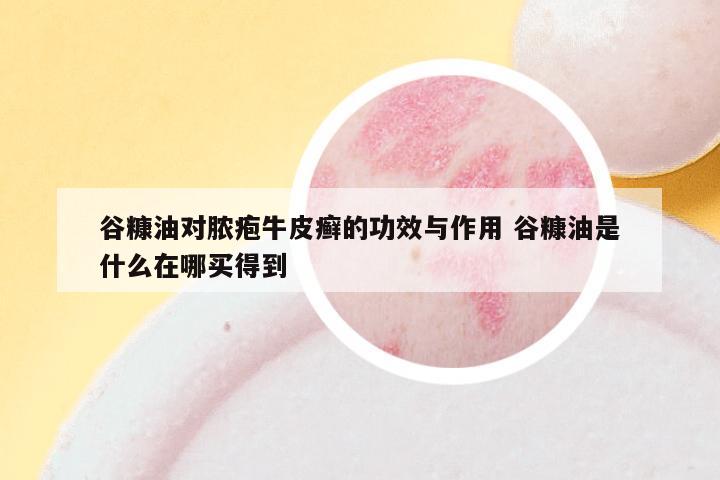 谷糠油对脓疱牛皮癣的功效与作用 谷糠油是什么在哪买得到