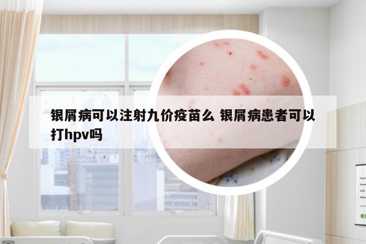 银屑病可以注射九价疫苗么 银屑病患者可以打hpv吗