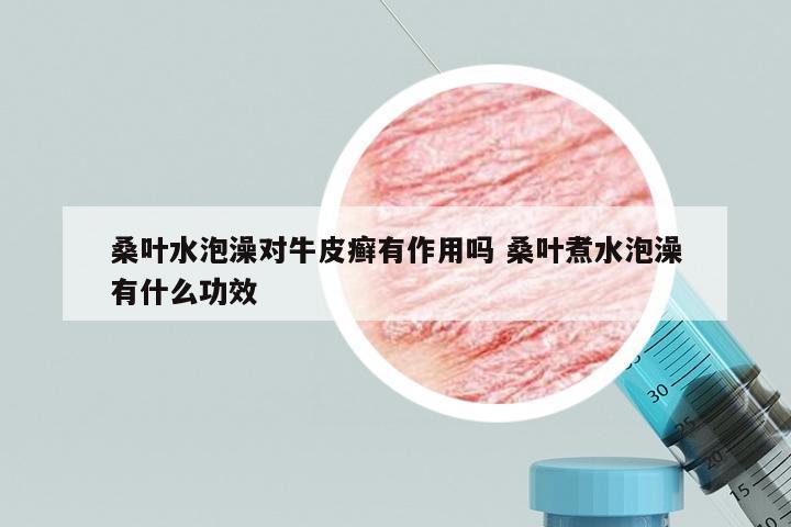 桑叶水泡澡对牛皮癣有作用吗 桑叶煮水泡澡有什么功效