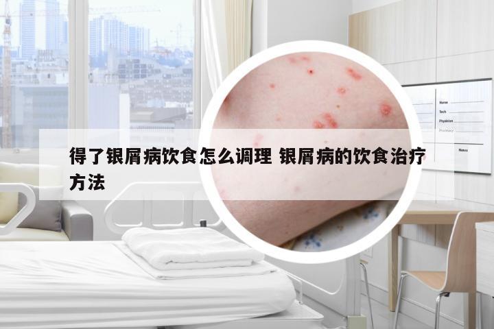 得了银屑病饮食怎么调理 银屑病的饮食治疗方法