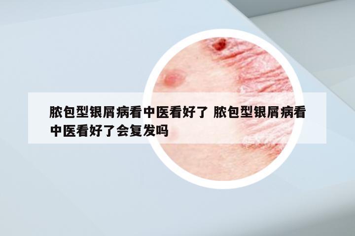 脓包型银屑病看中医看好了 脓包型银屑病看中医看好了会复发吗