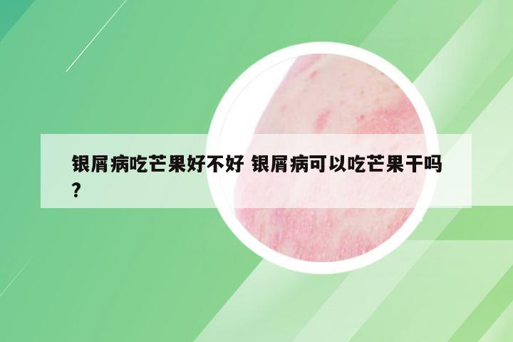银屑病吃芒果好不好 银屑病可以吃芒果干吗?