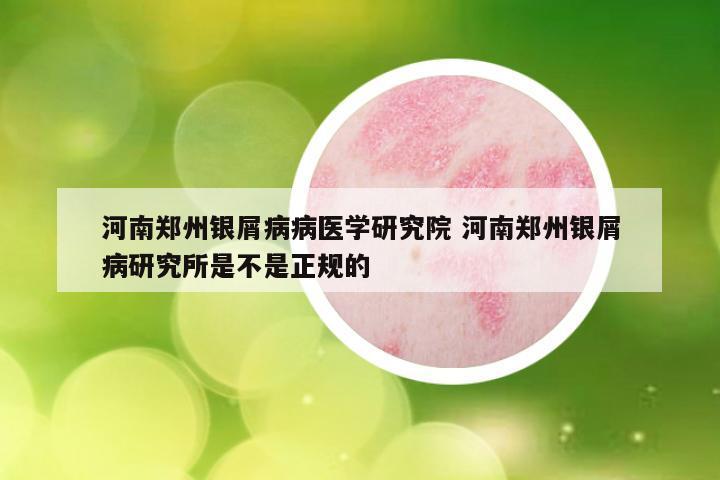 河南郑州银屑病病医学研究院 河南郑州银屑病研究所是不是正规的