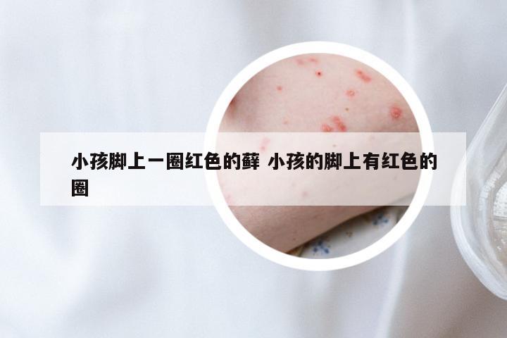 小孩脚上一圈红色的藓 小孩的脚上有红色的圈