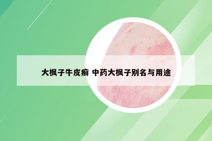 大枫子牛皮癣 中药大枫子别名与用途