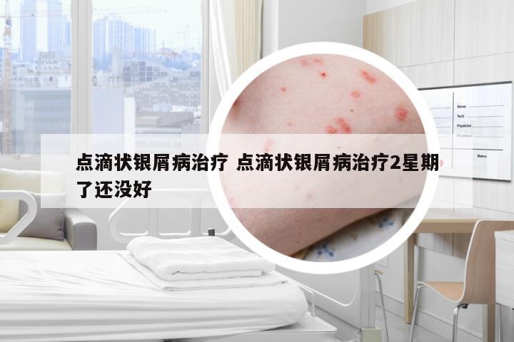 点滴状银屑病治疗 点滴状银屑病治疗2星期了还没好