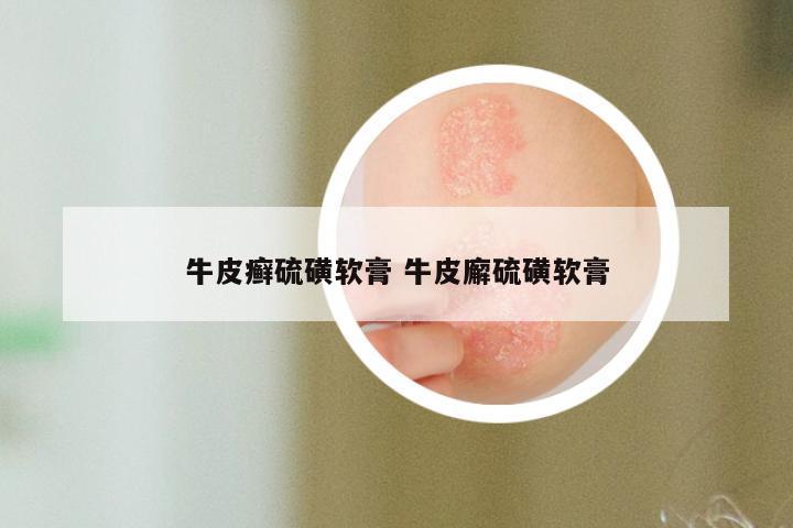 牛皮癣硫磺软膏 牛皮廨硫磺软膏