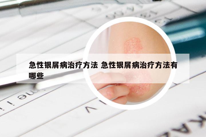 急性银屑病治疗方法 急性银屑病治疗方法有哪些