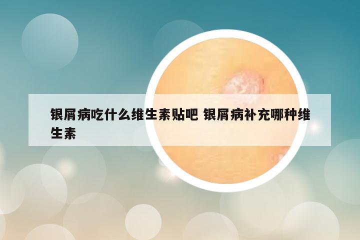 银屑病吃什么维生素贴吧 银屑病补充哪种维生素