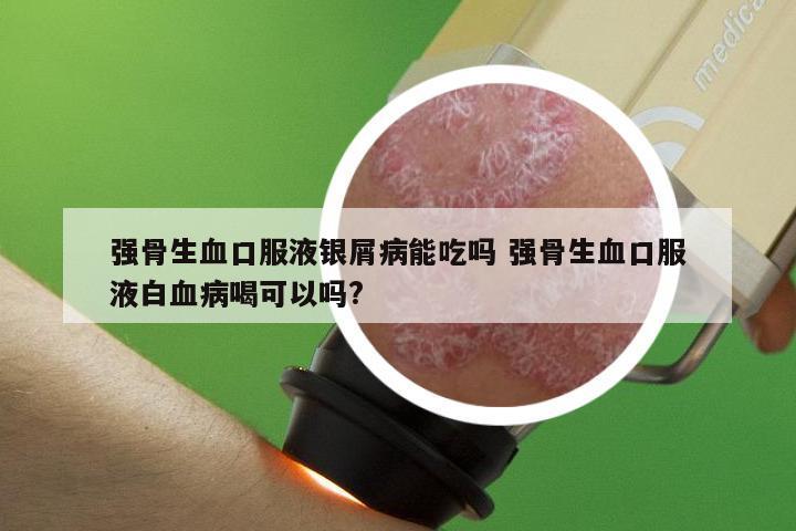 强骨生血口服液银屑病能吃吗 强骨生血口服液白血病喝可以吗?