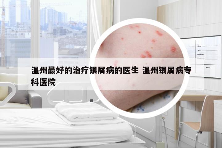 温州最好的治疗银屑病的医生 温州银屑病专科医院