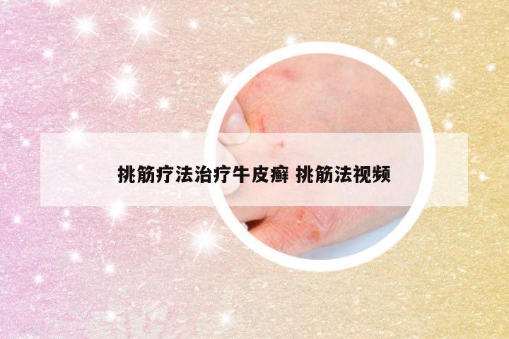 挑筋疗法治疗牛皮癣 挑筋法视频