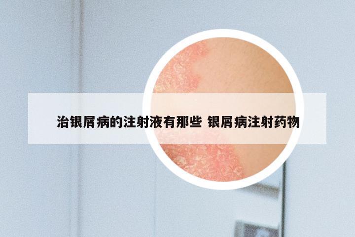 治银屑病的注射液有那些 银屑病注射药物