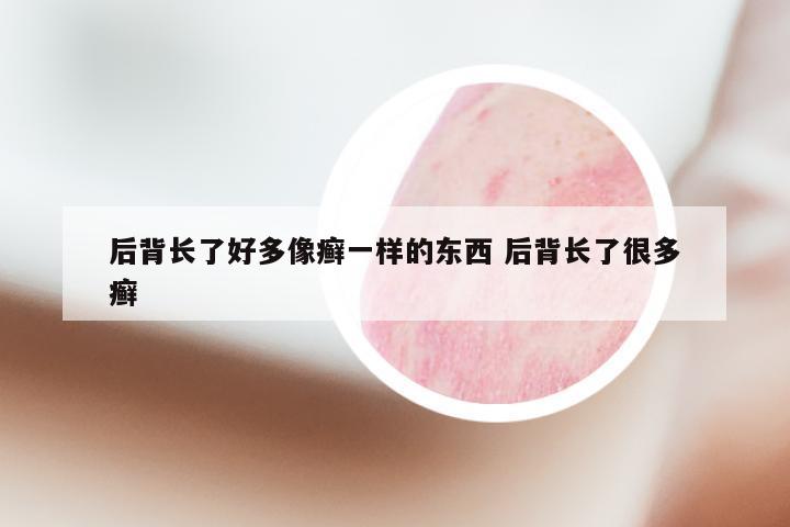 后背长了好多像癣一样的东西 后背长了很多癣