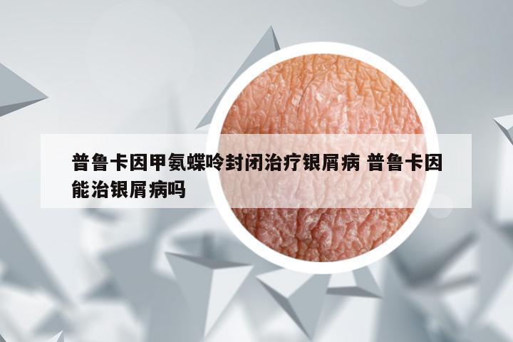 普鲁卡因甲氨蝶呤封闭治疗银屑病 普鲁卡因能治银屑病吗