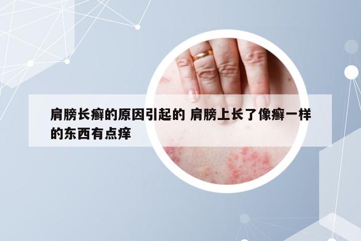 肩膀长癣的原因引起的 肩膀上长了像癣一样的东西有点痒