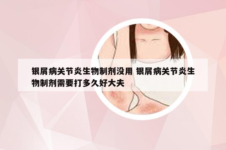银屑病关节炎生物制剂没用 银屑病关节炎生物制剂需要打多久好大夫
