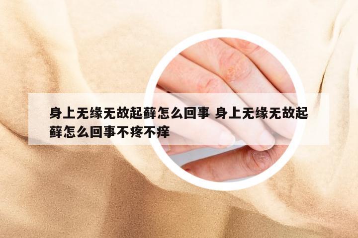 身上无缘无故起藓怎么回事 身上无缘无故起藓怎么回事不疼不痒