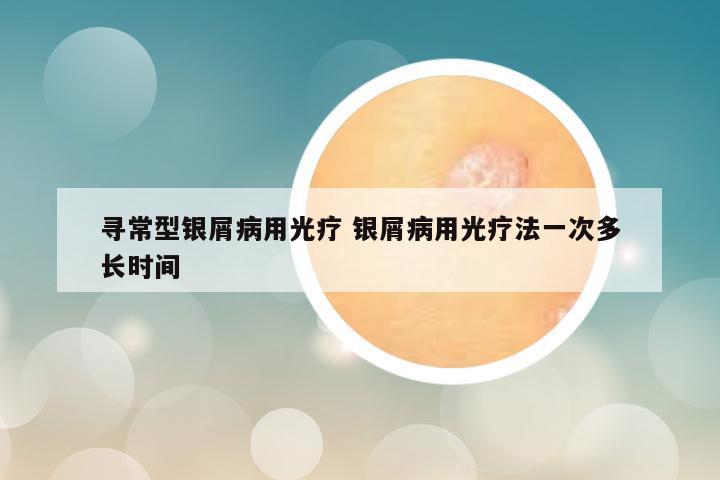 寻常型银屑病用光疗 银屑病用光疗法一次多长时间