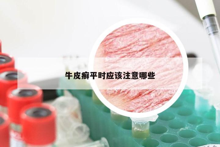 牛皮癣平时应该注意哪些