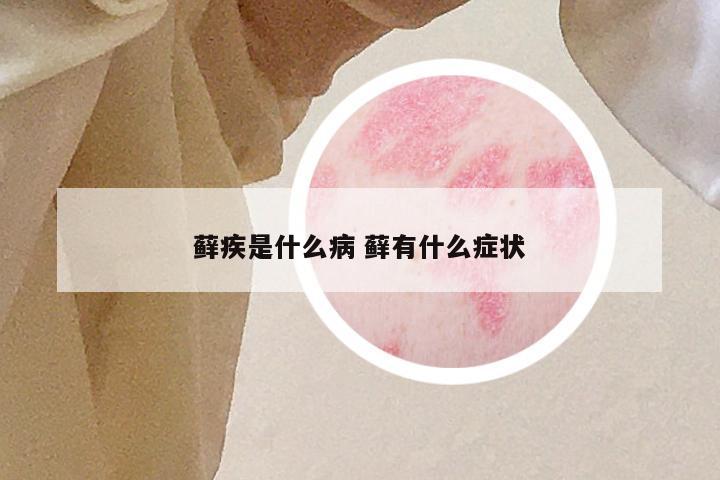 藓疾是什么病 藓有什么症状