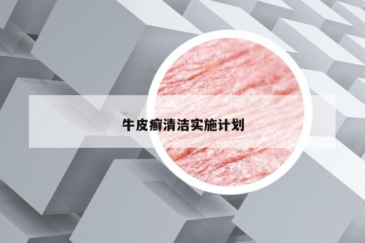 牛皮癣清洁实施计划