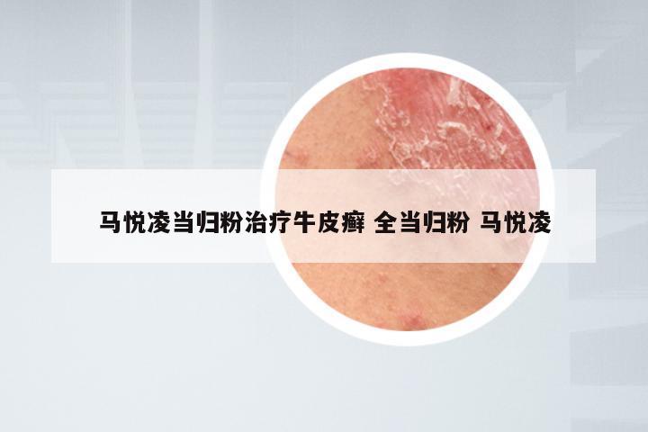 马悦凌当归粉治疗牛皮癣 全当归粉 马悦凌