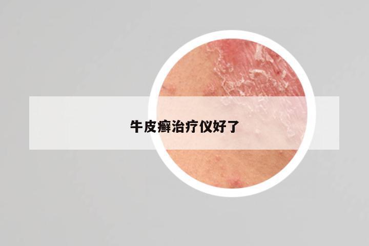 牛皮癣治疗仪好了