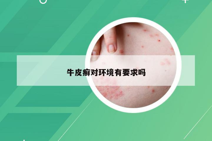 牛皮癣对环境有要求吗