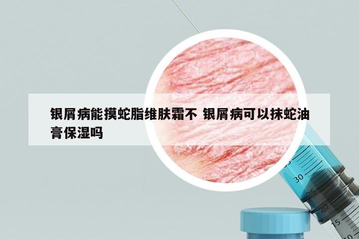 银屑病能摸蛇脂维肤霜不 银屑病可以抹蛇油膏保湿吗