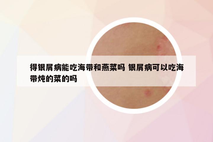 得银屑病能吃海带和燕菜吗 银屑病可以吃海带炖的菜的吗